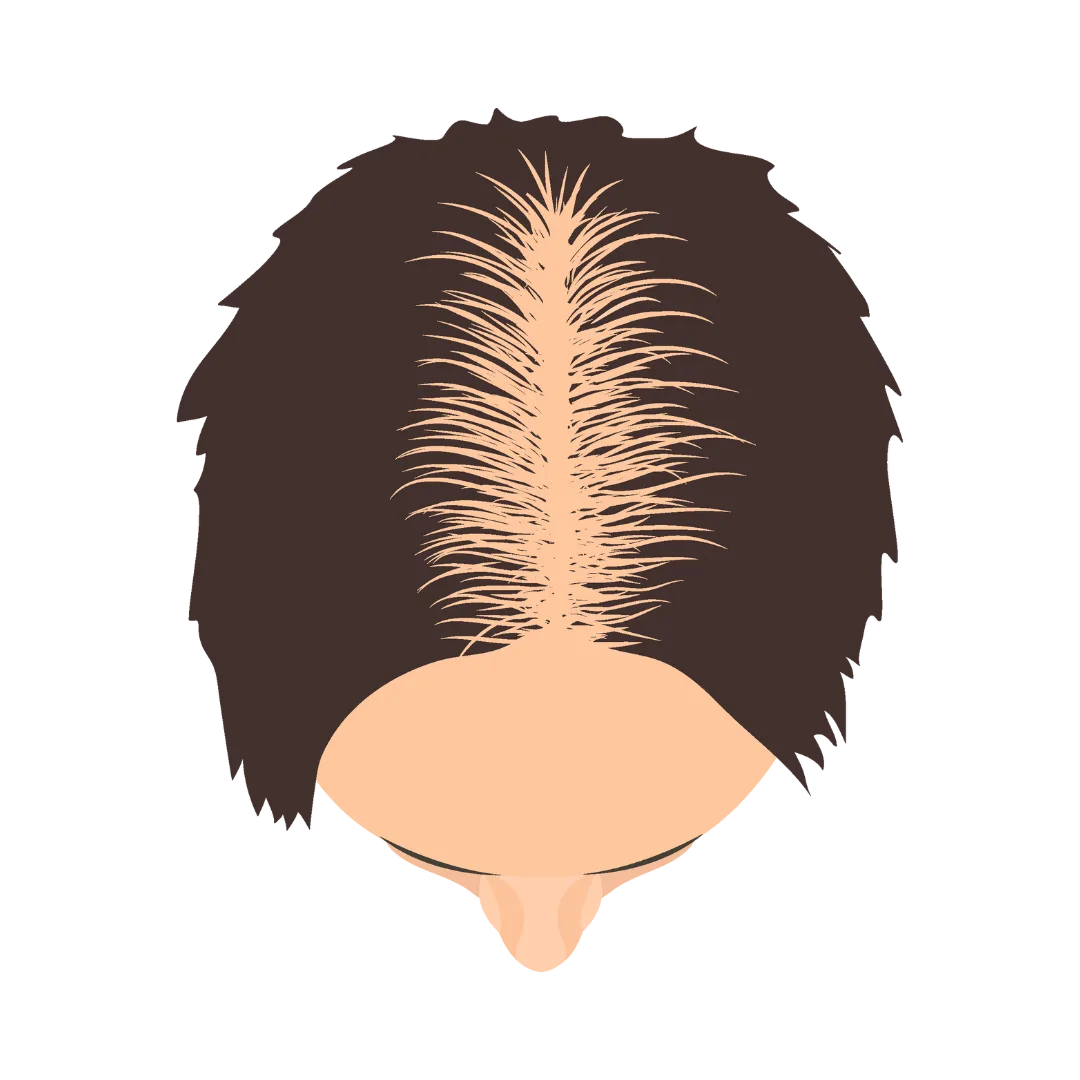 hair