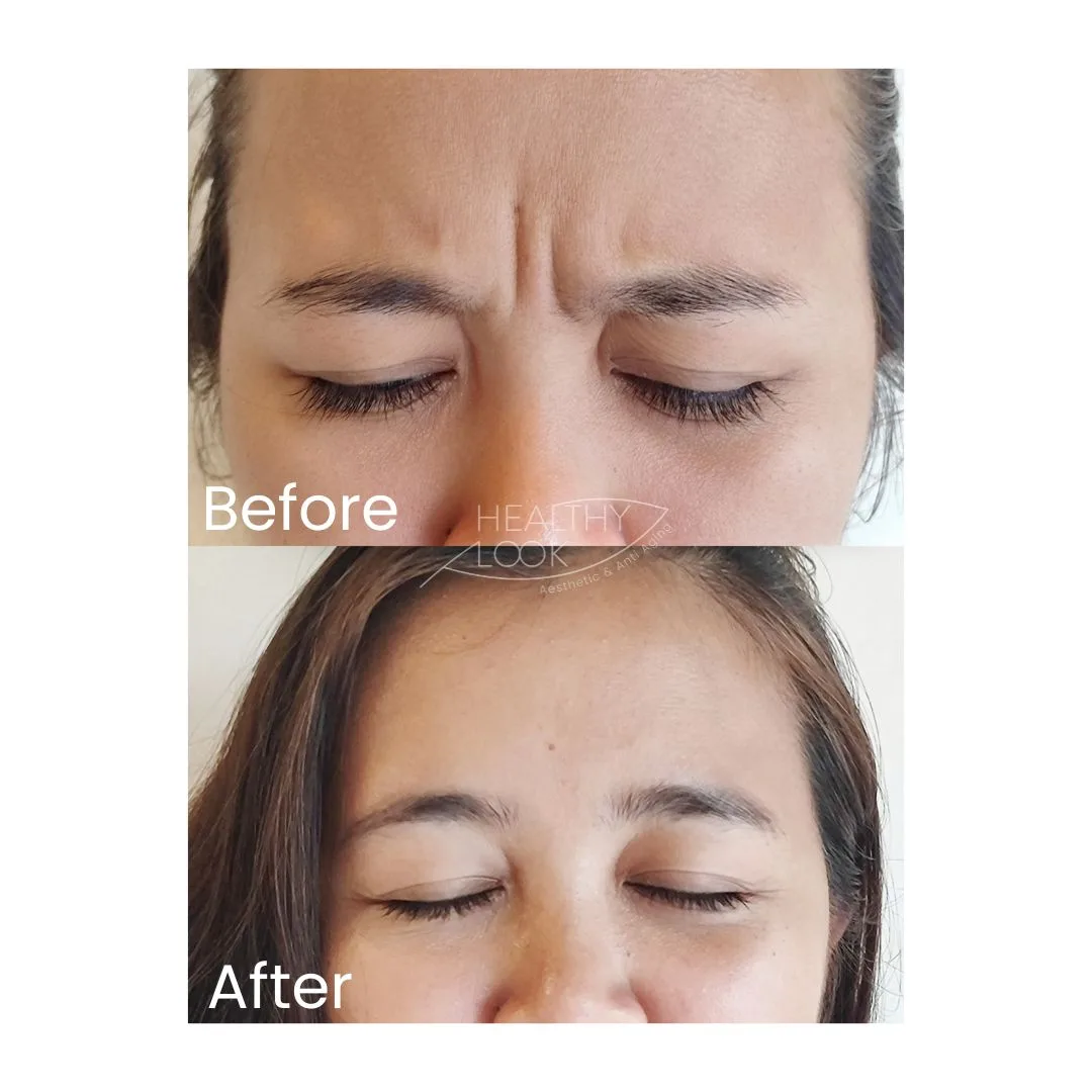 before after treatment