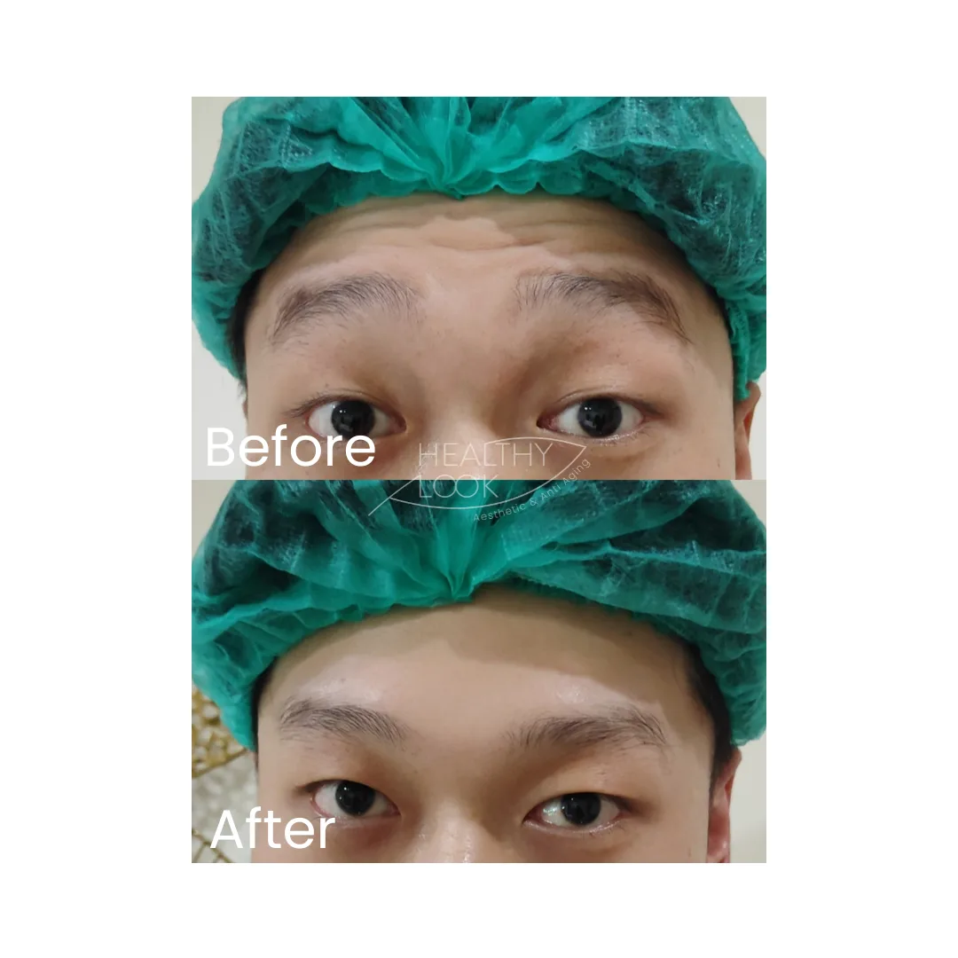 before after treatment