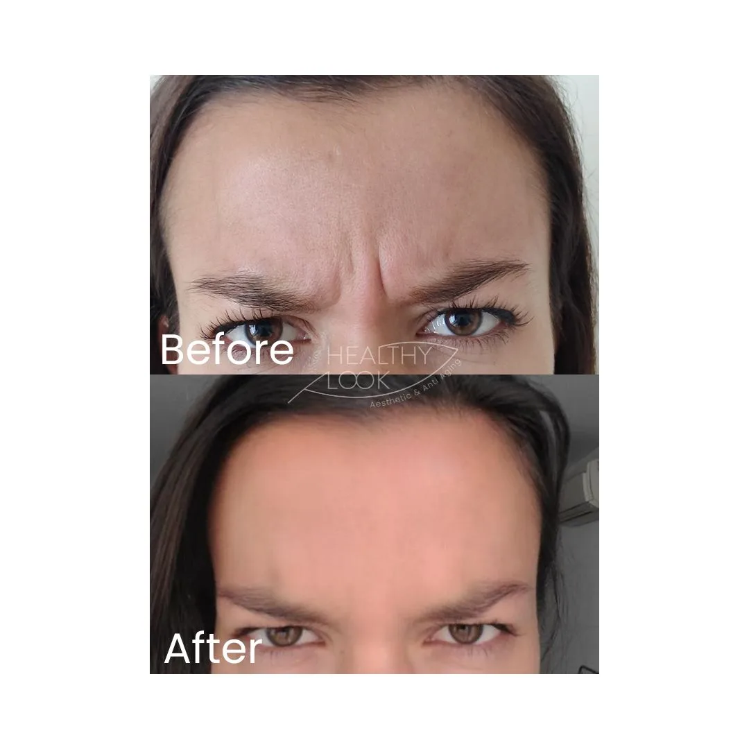 before after treatment