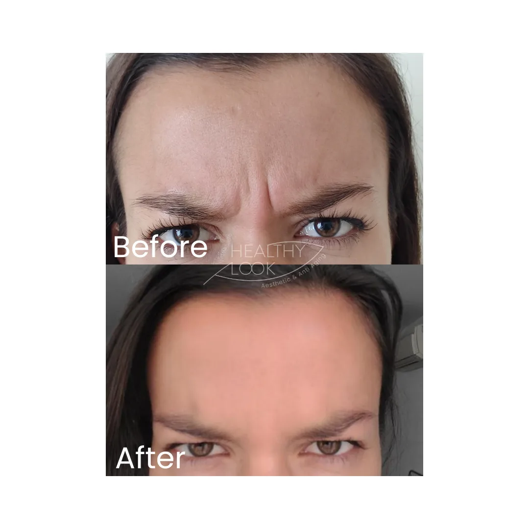 before after treatment