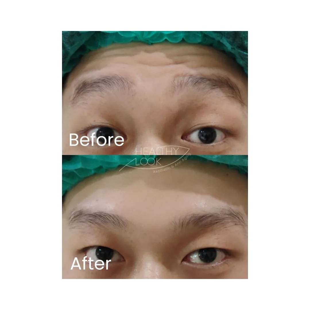 before after treatment