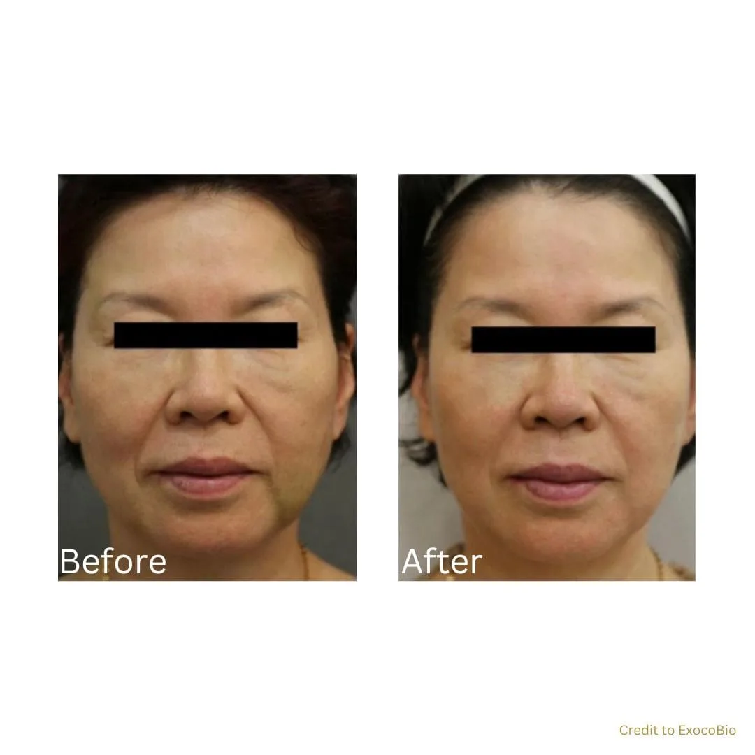 before after treatment