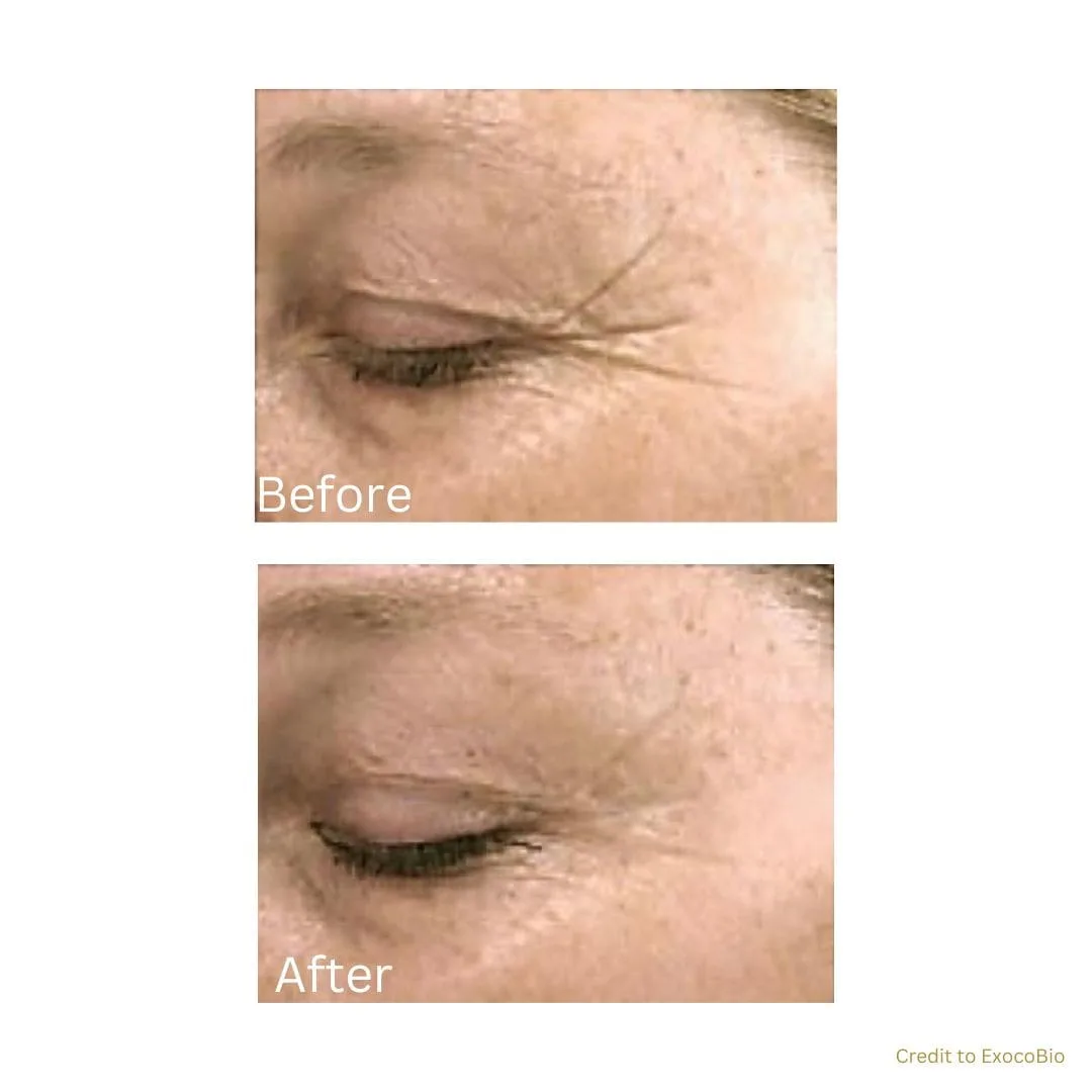 before after treatment