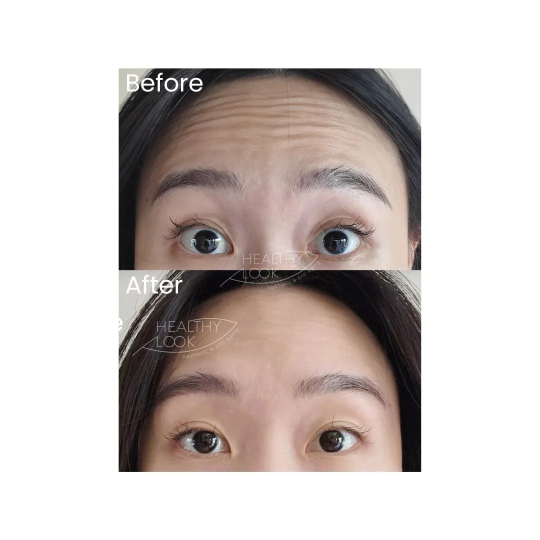 before after treatment