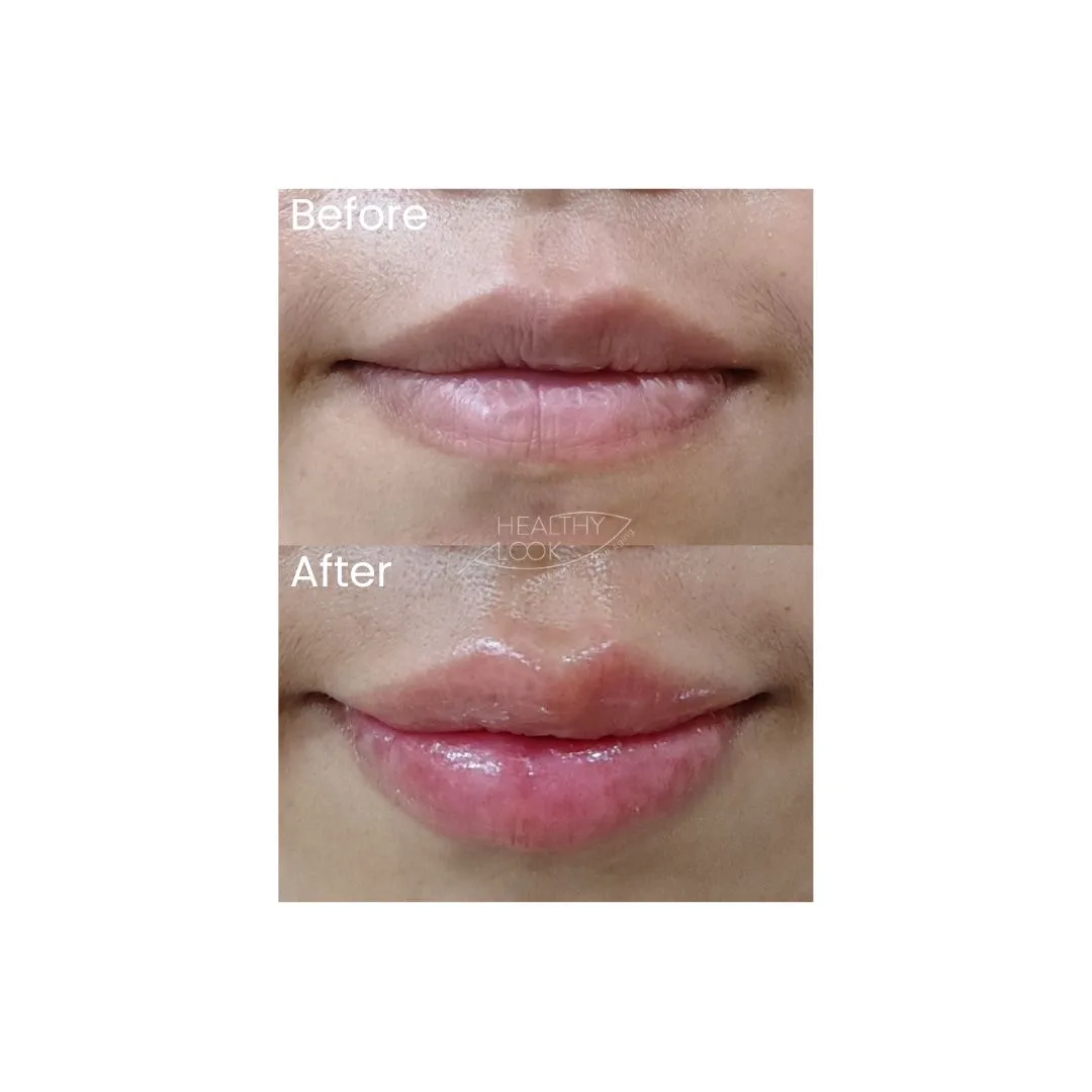 before after treatment