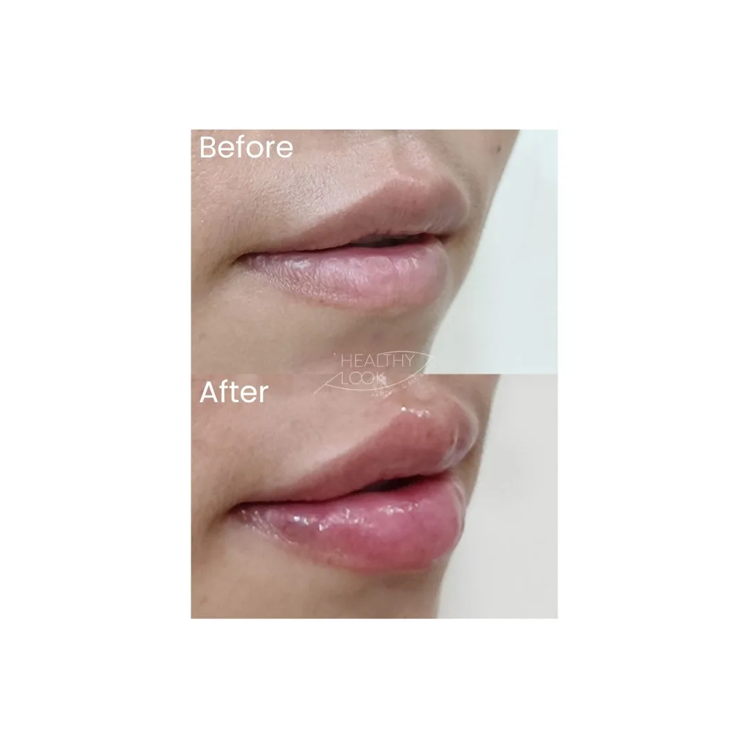 before after treatment