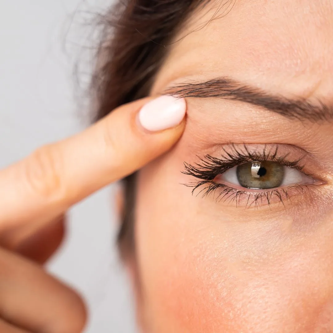 Droppy Eyelid
