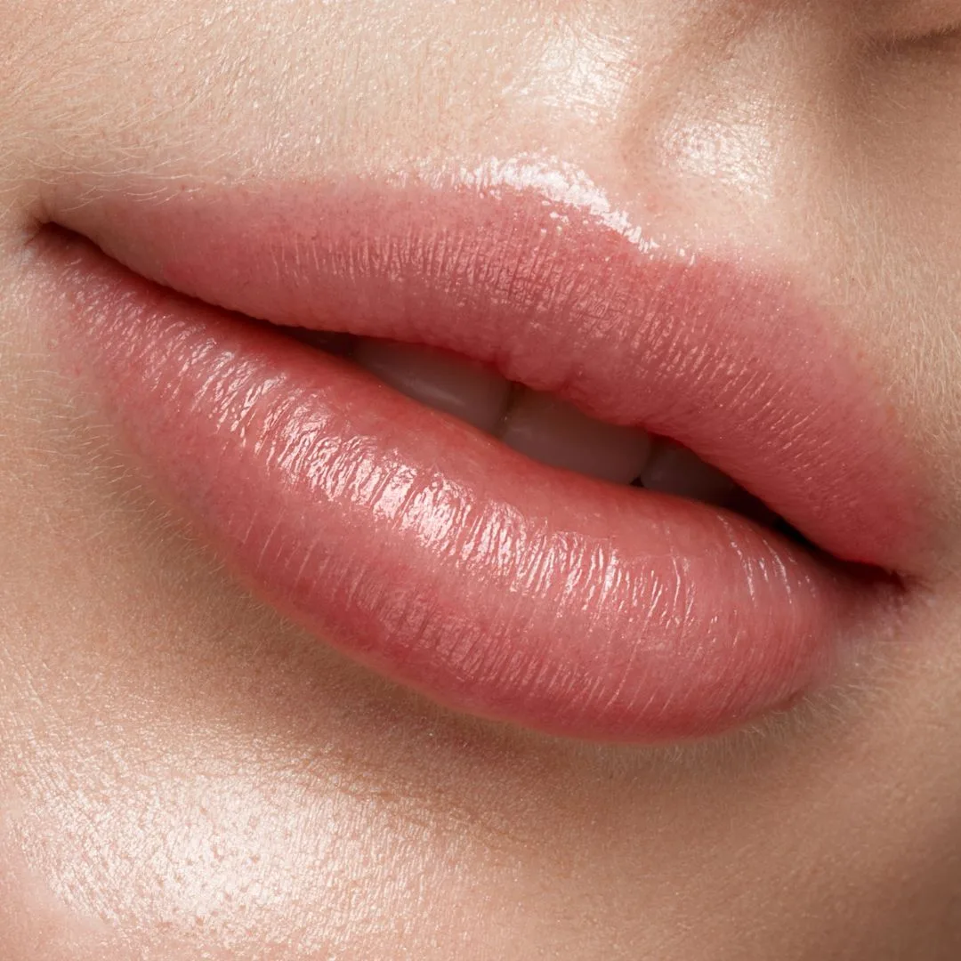 lip filler treatment