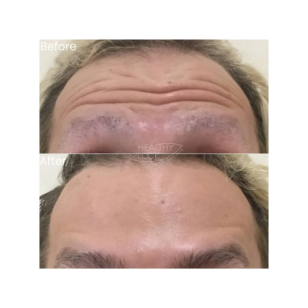 before after treatment