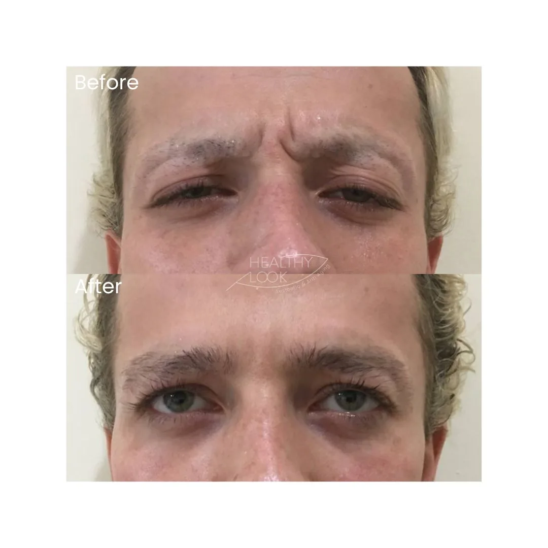 before after treatment