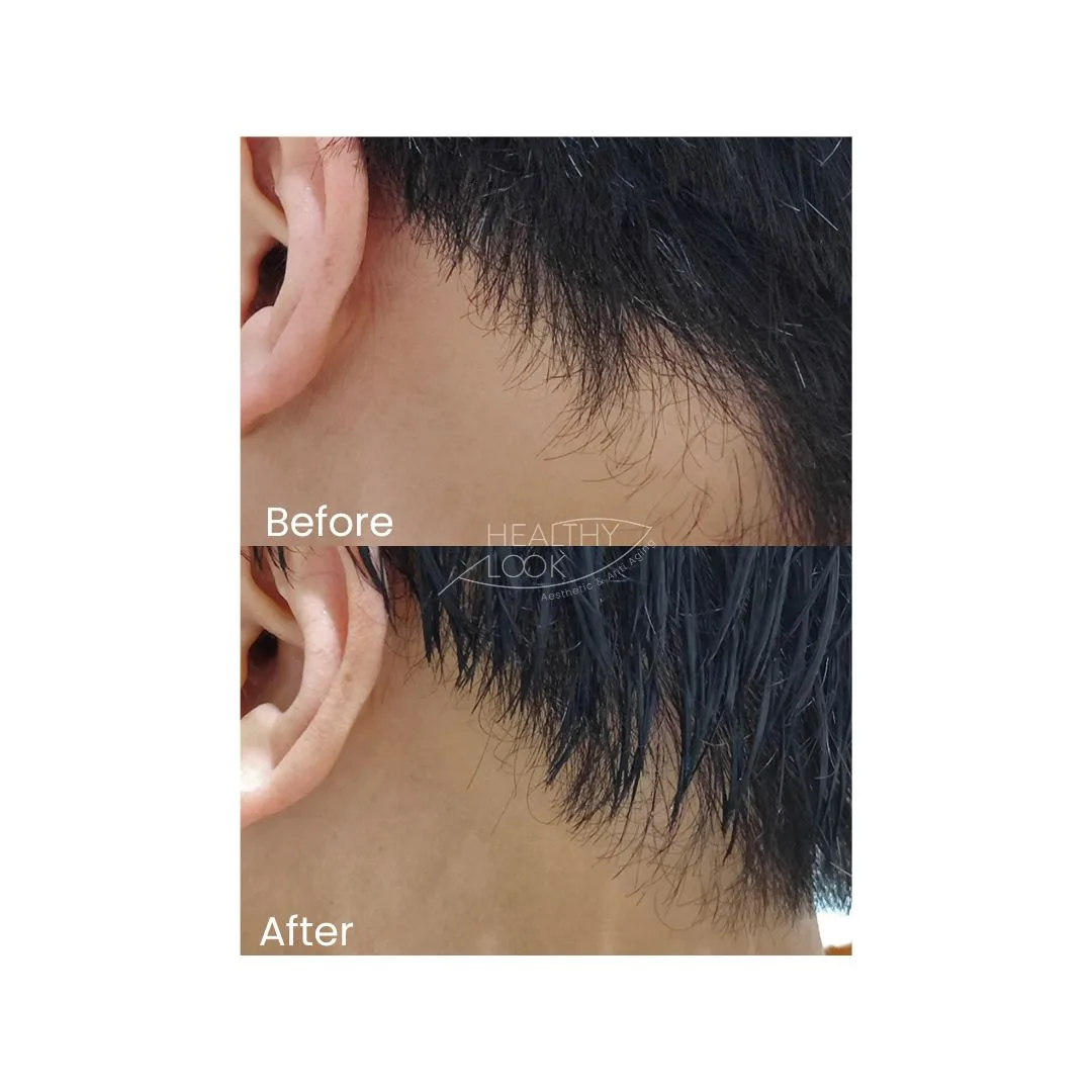 before after treatment