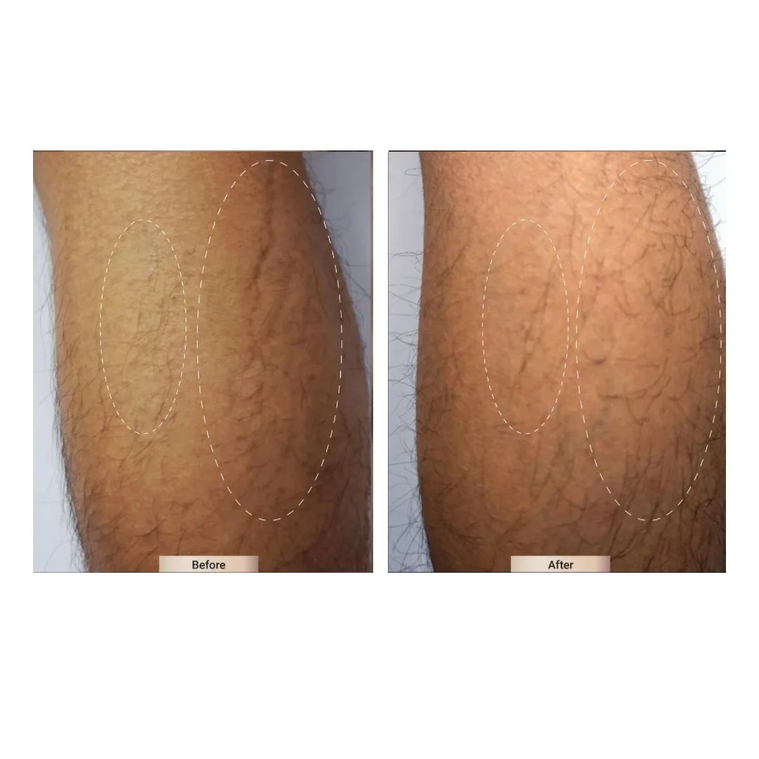 before after treatment