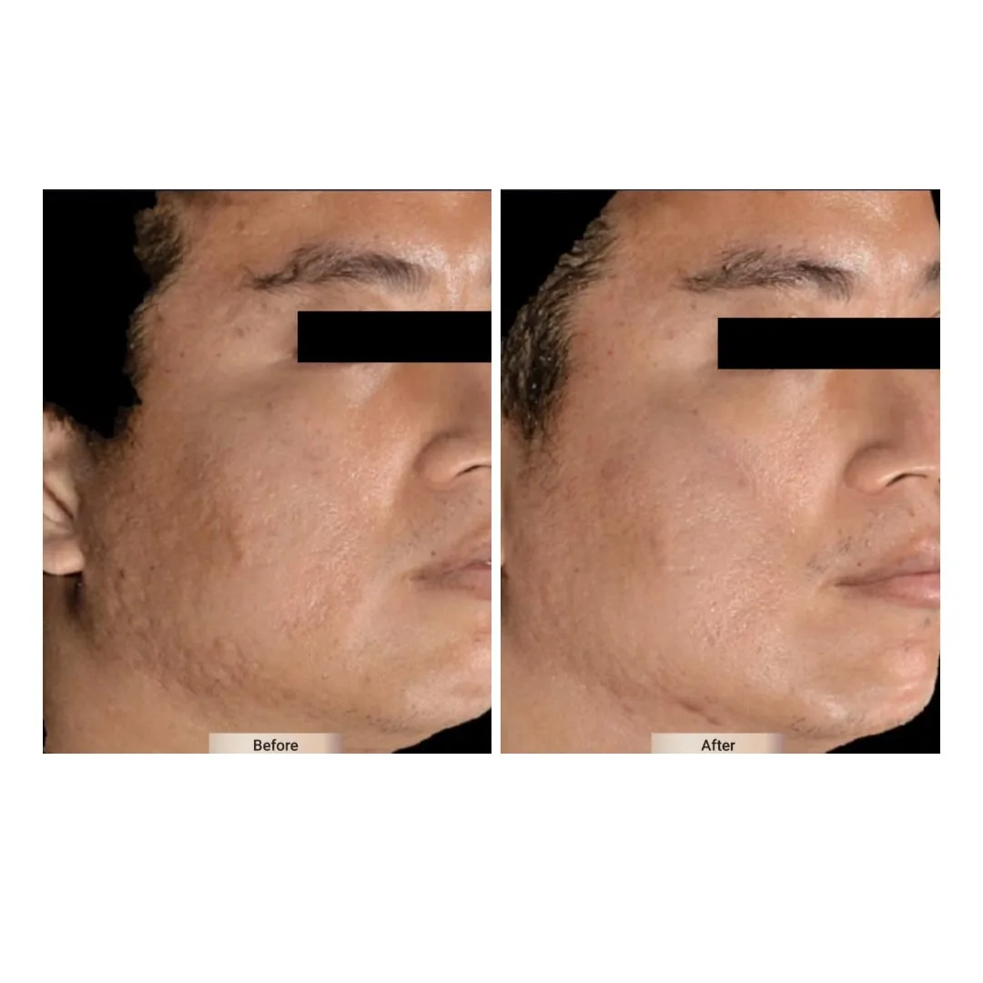 before after treatment
