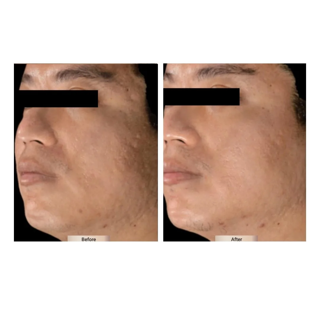 before after treatment