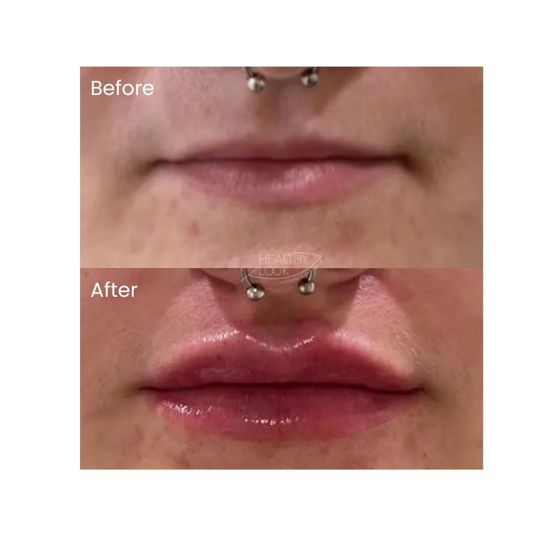 before after treatment