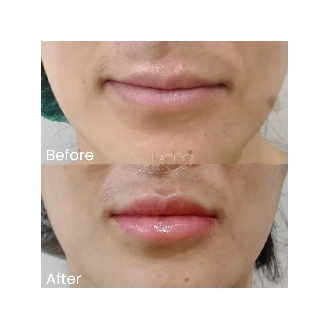 before after treatment