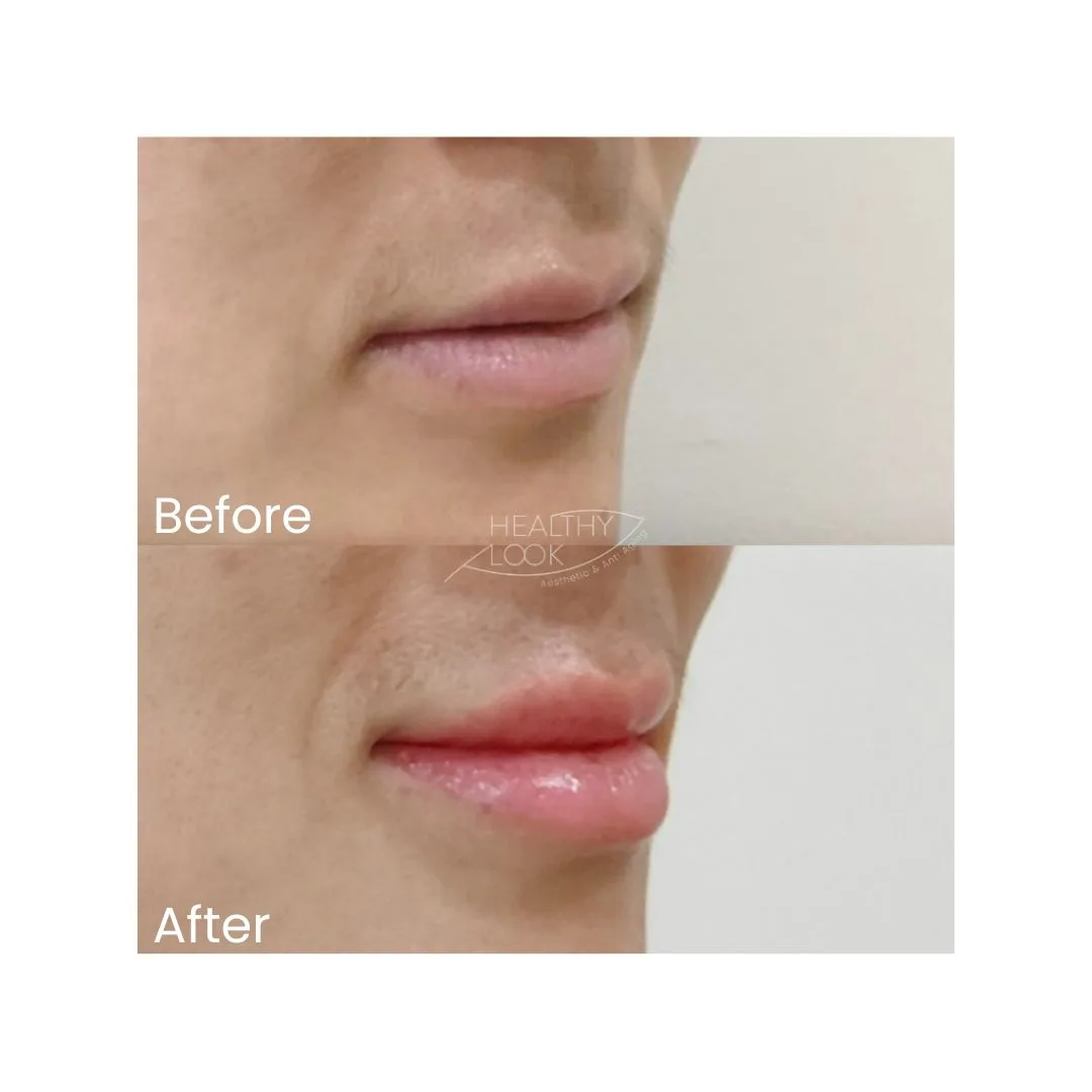 before after treatment