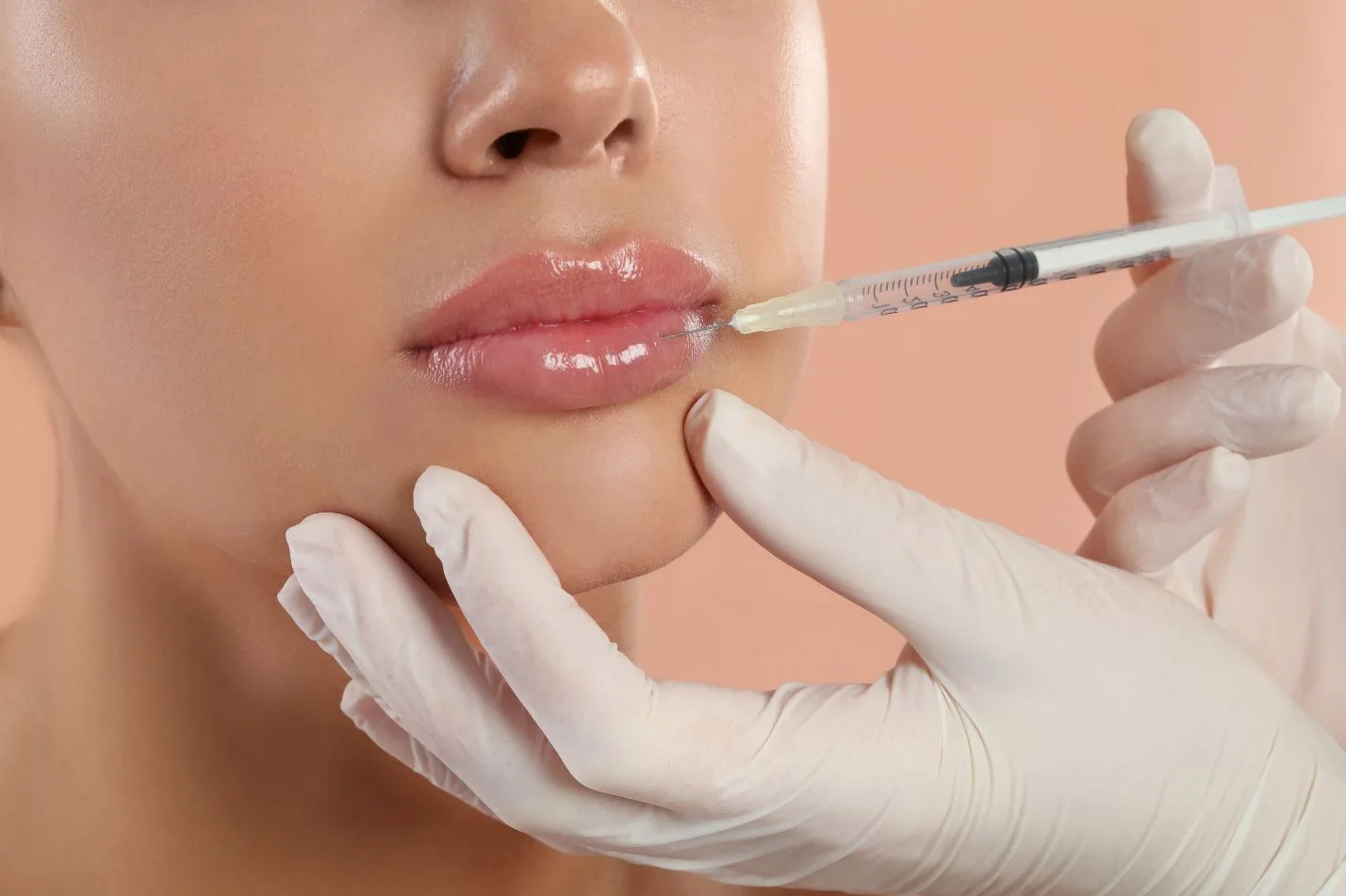 lip filler treatment
