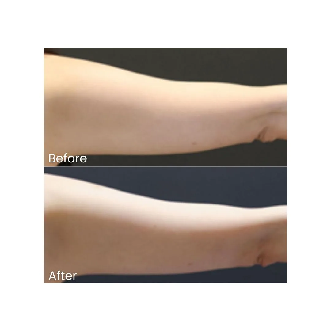 before after treatment