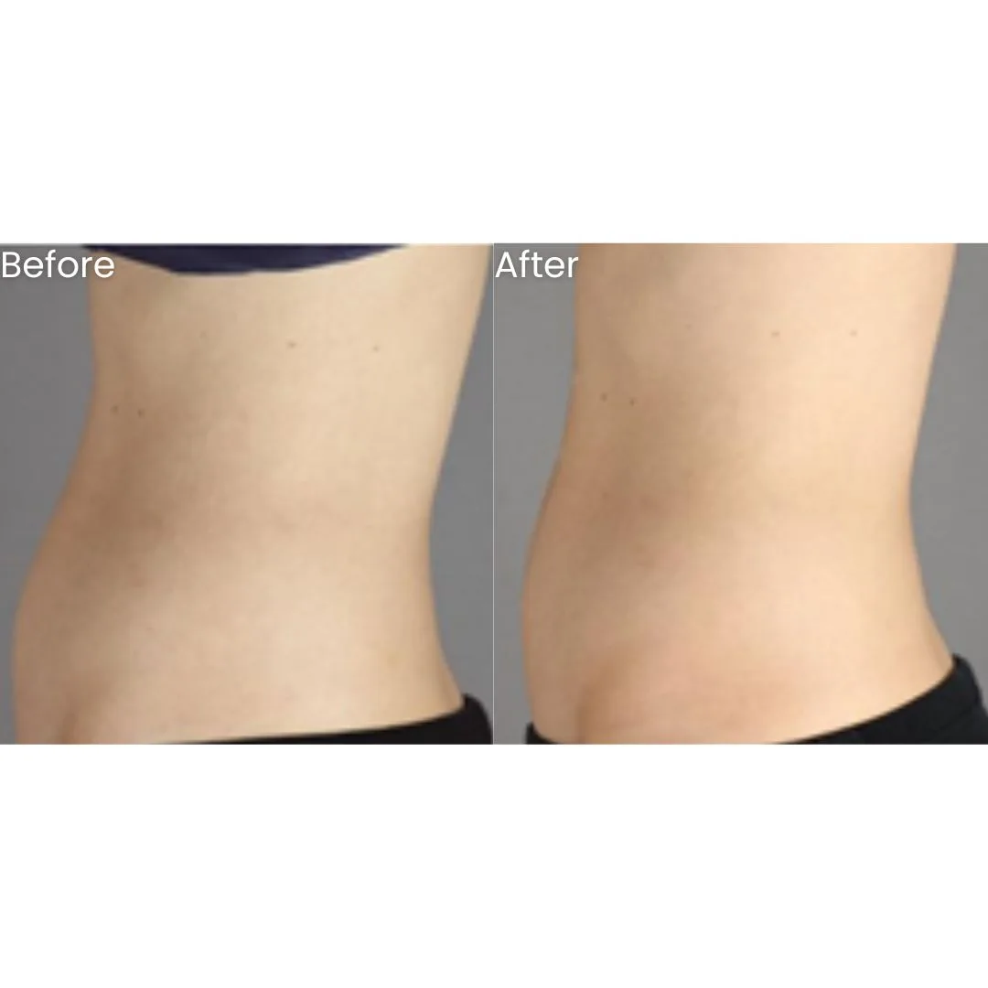 before after treatment