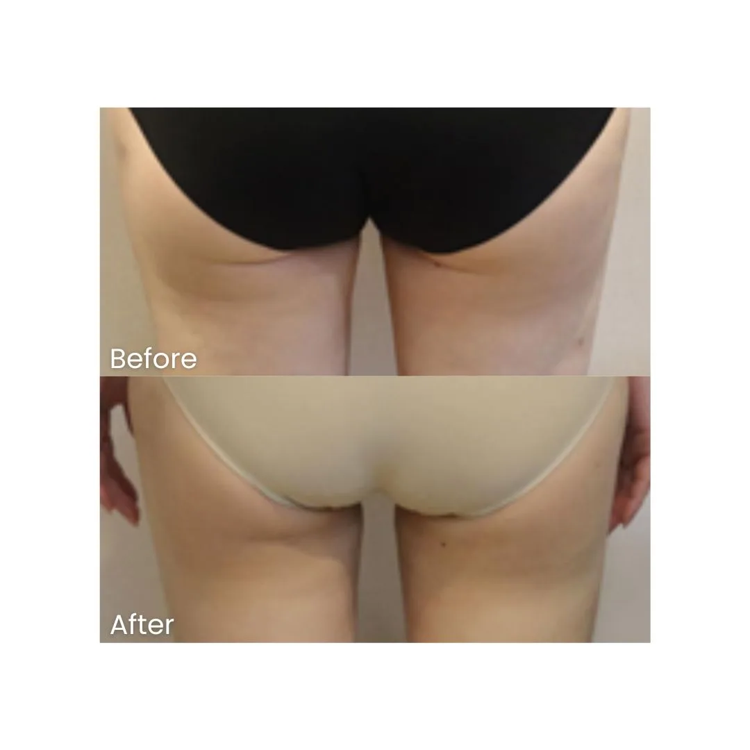 before after treatment